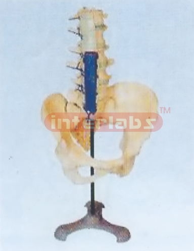 EXPANSION LUMBAR VERTEBRAL COLUMN MODEL